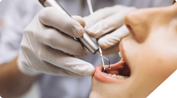 Les Mini vis orthodontiques chez l'adulte Le Perreux sur Marne (94170)   Cabinet d'Implantologie et de Parodontologie du Dr Terence Ammanou Dentiste  au Perreux sur Marne